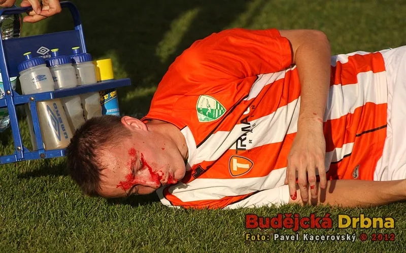 Zkrvavený Patrik Kössl skončil s podezřením na otřes mozku v nemocnici
