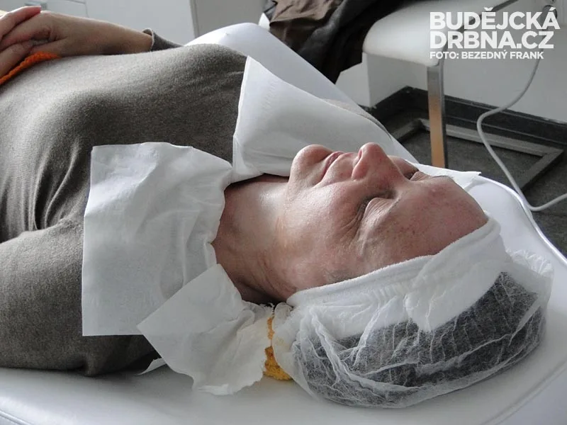 Omlazení obličeje bipolární radiofrekvencí v Amaryllis Beauty Institutu