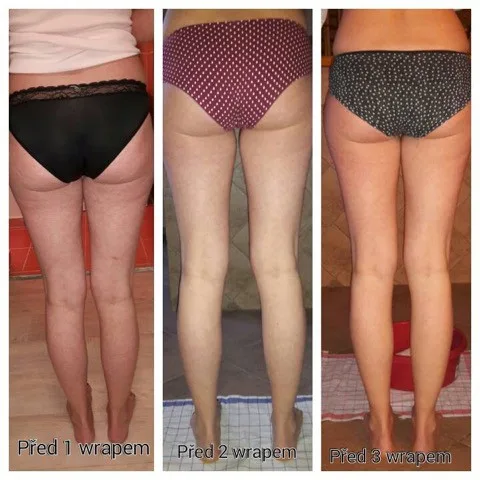 Body Wraps