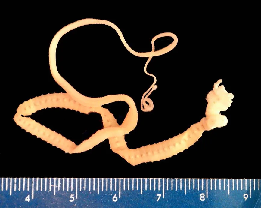 Diphyllobothrium latum