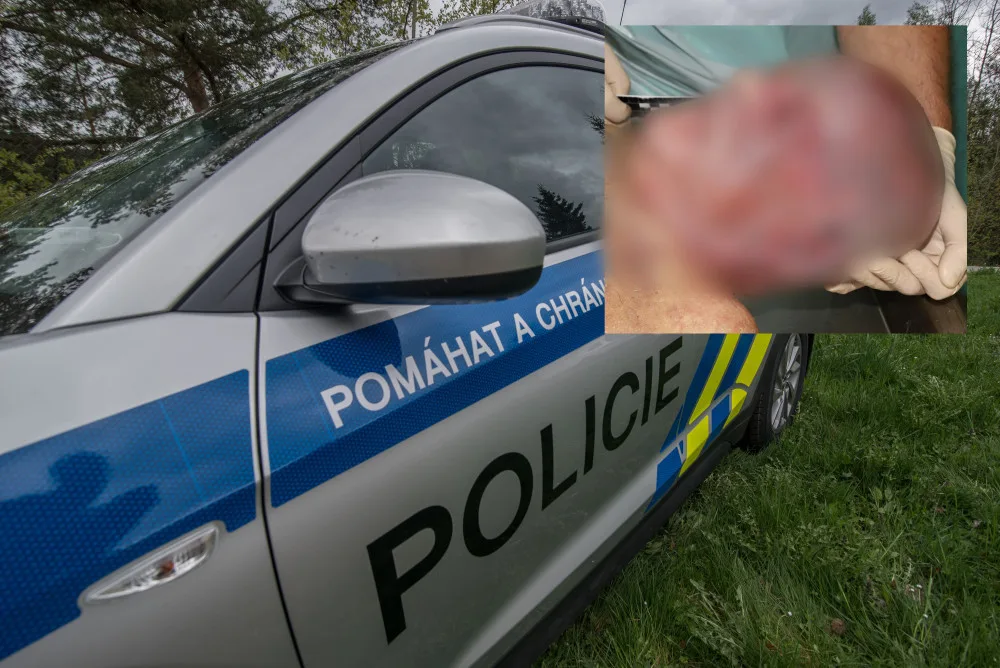 Policie zná totožnost muže zavražděného u Nové Pece. K identifikaci pomohl kyčelní implantát