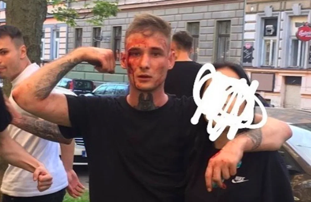 Jeden z aktérů po konfliktu u Žižkárny.