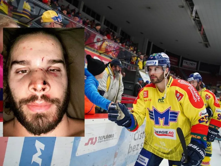 David Gilbert je po operaci. Ošklivé zranění si hokejista způsobil při tréninku.