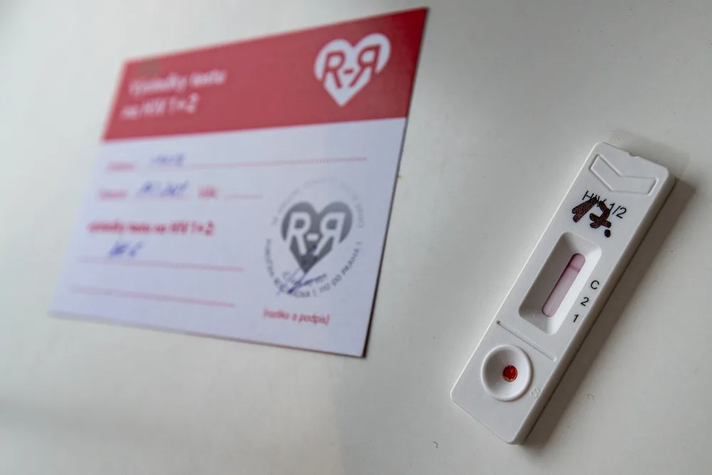Nákaza HIV je stále aktuální. Rozkoš bez rizika vyráží se svou testovací sanitkou na jih Čech