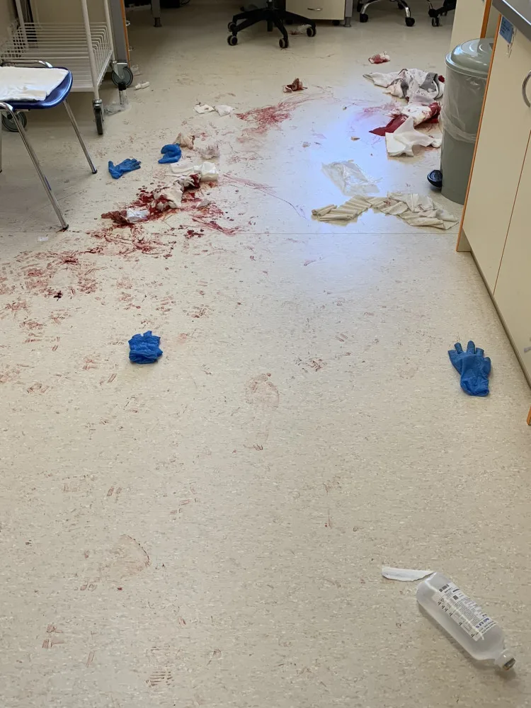 Drama v Českých Budějovicích. Muž zaútočil mačetou na psychiatrickém oddělení