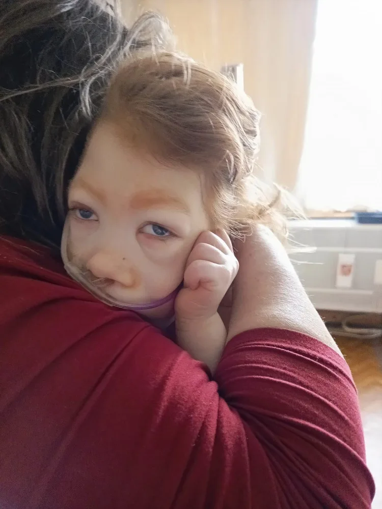 Syn má poškozený mozek a nedožije se rána, řekli Tereze po porodu. Míša teď oslaví tři roky a mamince dává velkou sílu