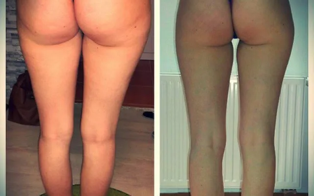 Body Wraps