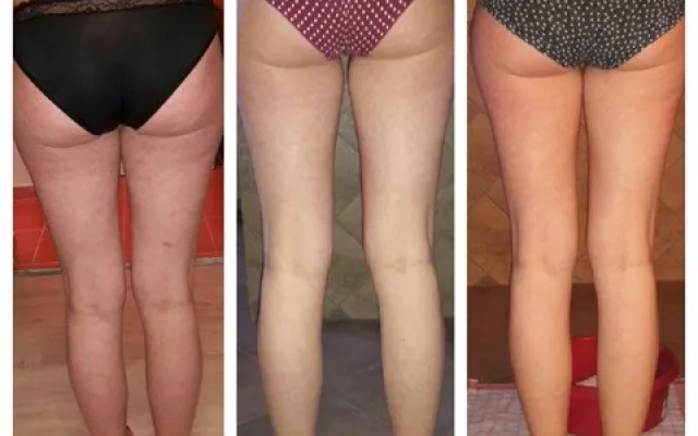 Body Wraps