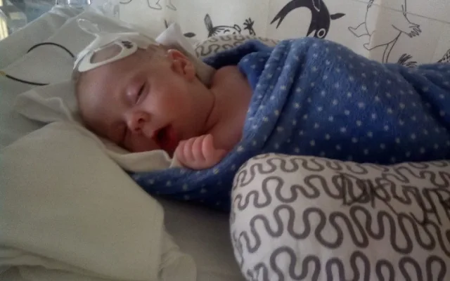Dominik se narodil se třemi oušky a rozštěpem rtu, lékaři u něj objevili vzácné onemocnění