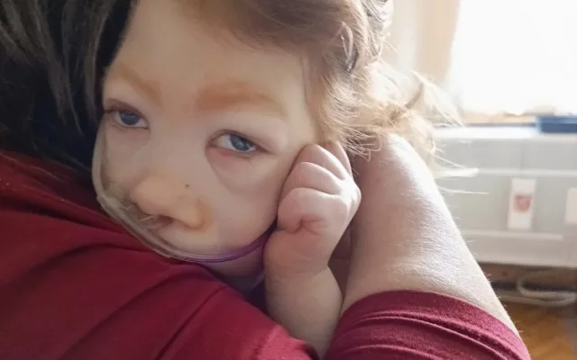 Syn má poškozený mozek a nedožije se rána, řekli Tereze po porodu. Míša teď oslaví tři roky a mamince dává velkou sílu