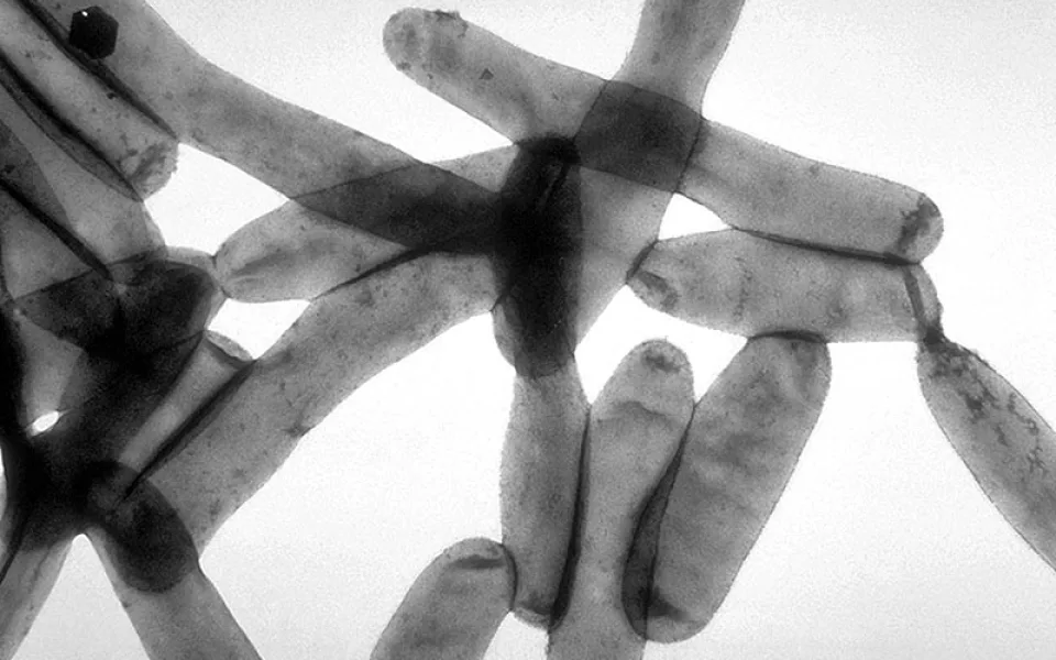 Legionella pneumophila