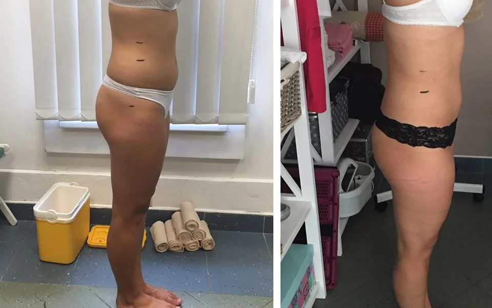 Body Wraps