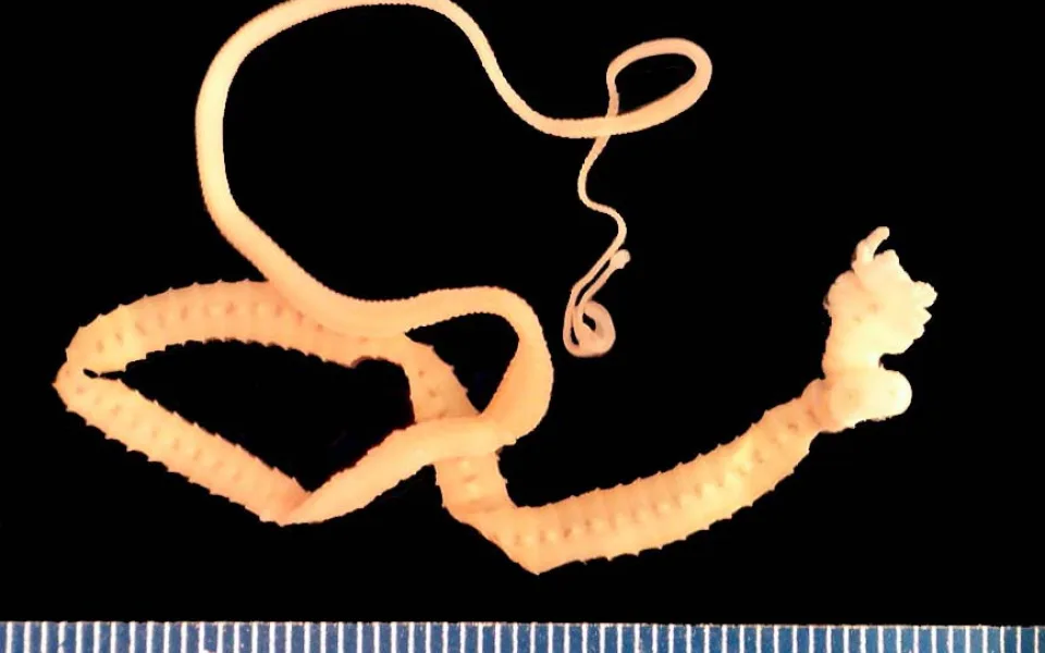 Diphyllobothrium latum