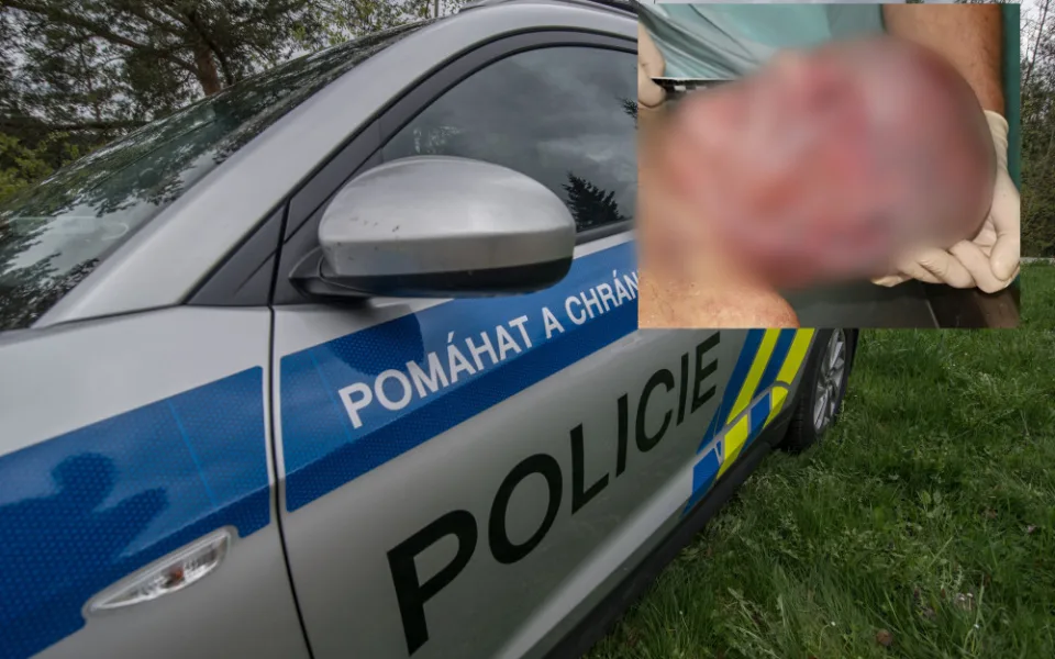 Policie zná totožnost muže zavražděného u Nové Pece. K identifikaci pomohl kyčelní implantát