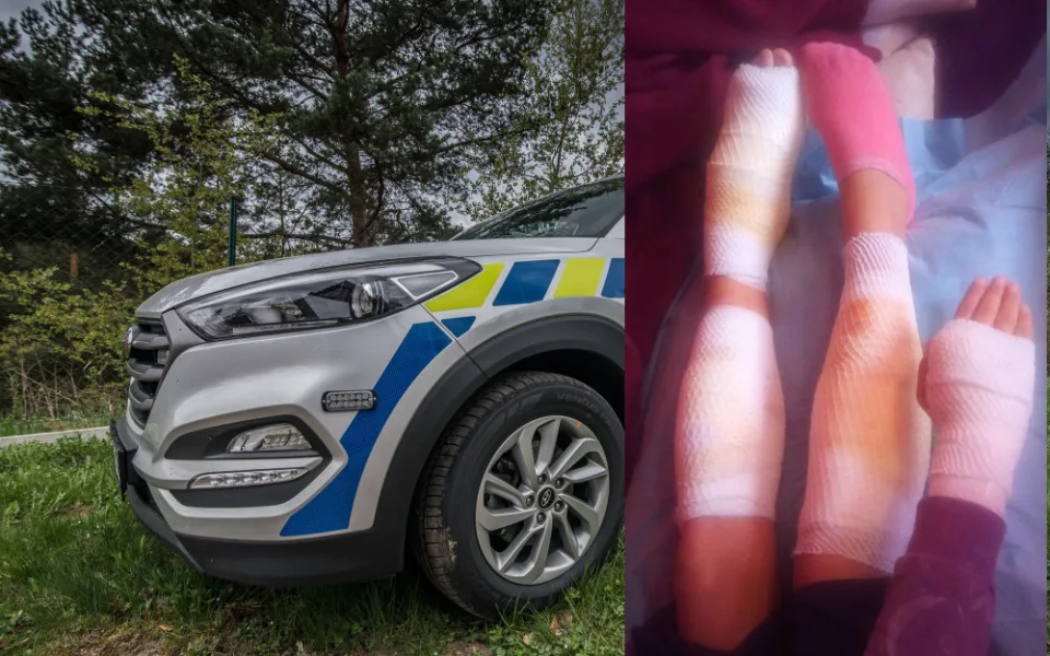 Pokousaná dívka