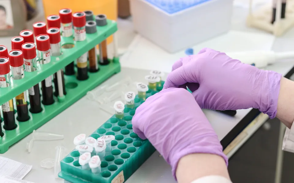 Česká společnost AIDS pomoc obnovila testování HIV v pevných CheckPointech