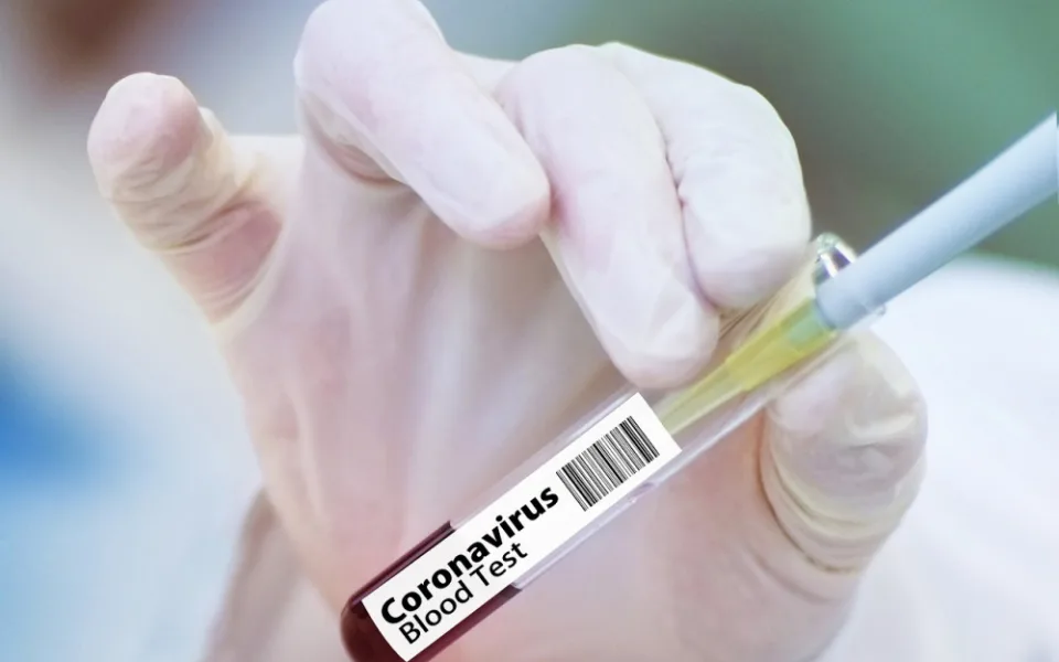 Na Strakonicku a Písecku začalo testování, které u lidí zjistí přítomnost protilátek na koronavir