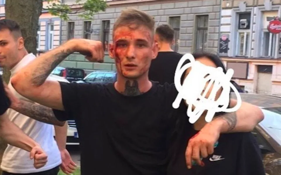 Jeden z aktérů po konfliktu u Žižkárny.
