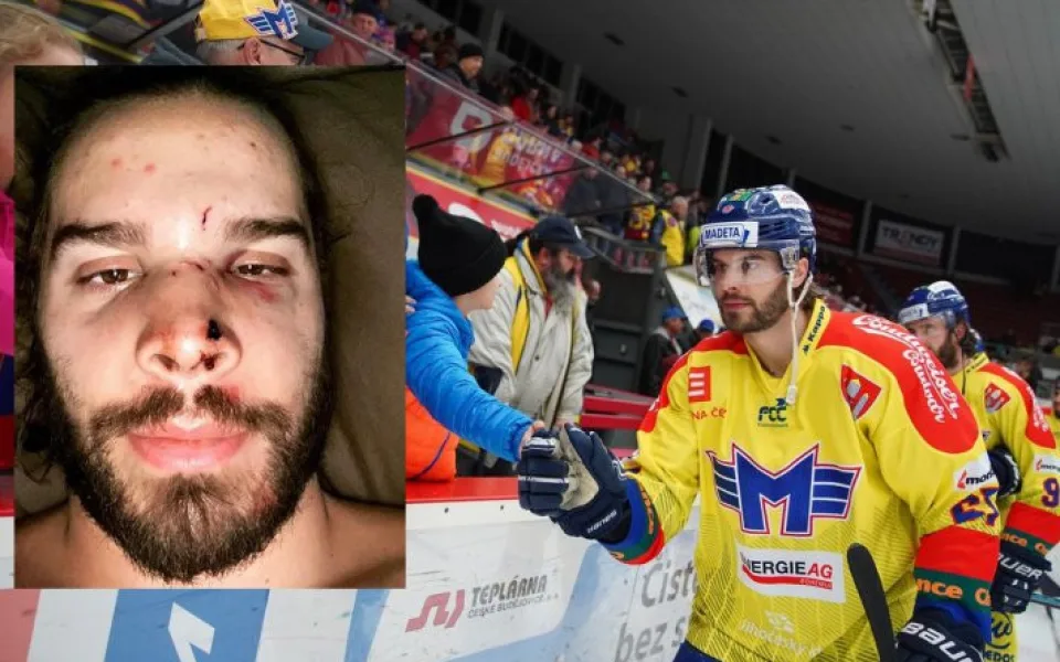David Gilbert je po operaci. Ošklivé zranění si hokejista způsobil při tréninku.