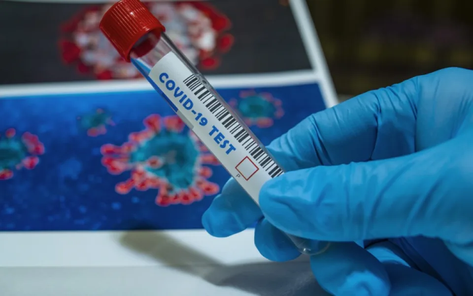 Jihočeští hygienici za týden evidovali přes čtyři tisíce případů covidu, méně než před týdnem