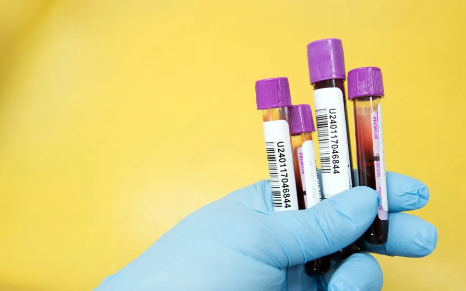 Za trošku krve klidné spaní. Jednoduchý test z krve může odhalit riziko rakoviny prostaty nebo od obav ulevit