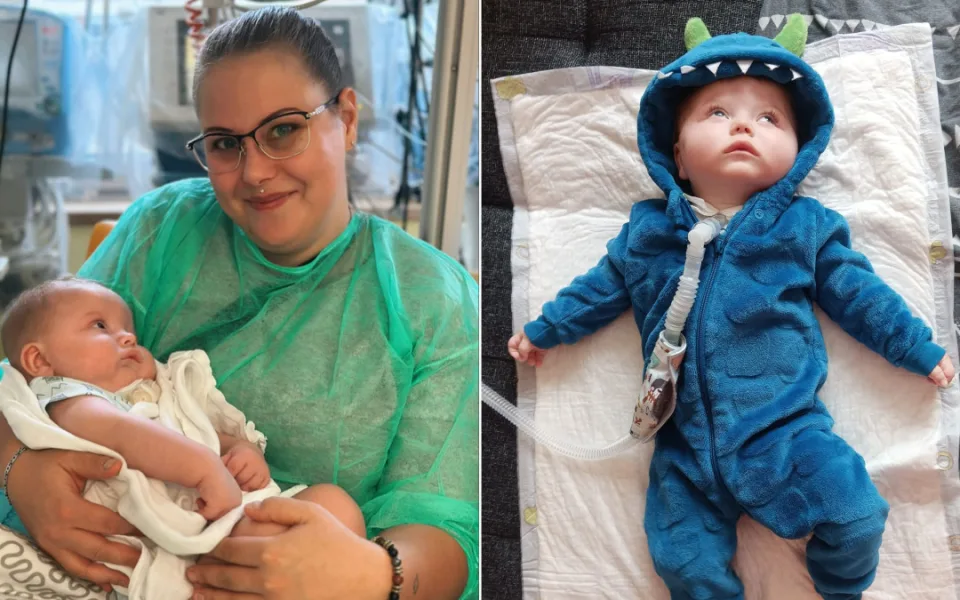 Maličký Jiřík trpí vzácnou genetickou poruchou. Má ji jen několik desítek lidí na světě